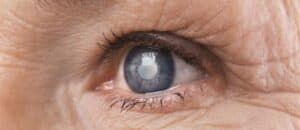 Premium Cataract Surgery